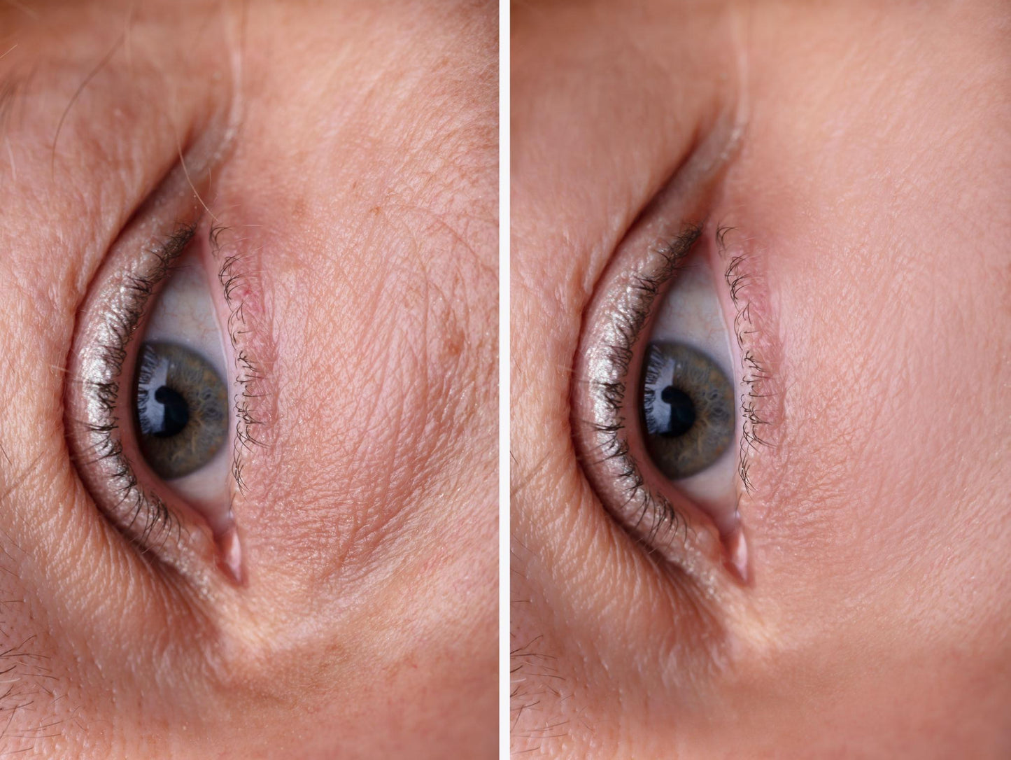 DR MELAXIN EYE CREAM