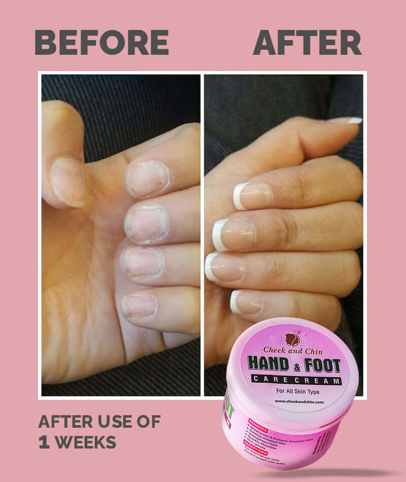 HAND AND FOOT CREAM