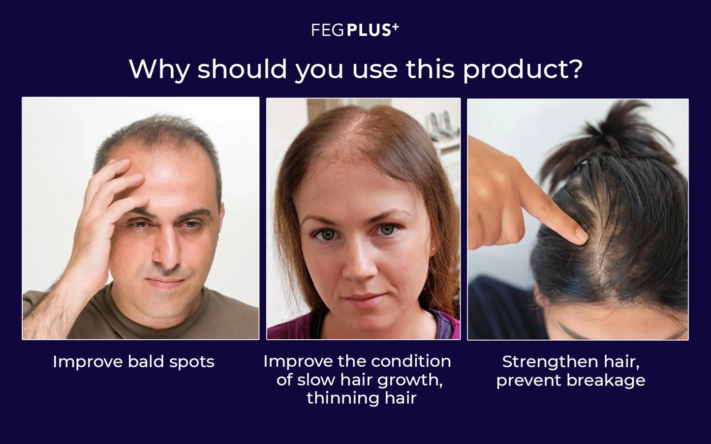 FEG PLUS HAIR SPRAY