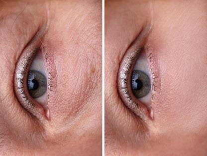 DR MELAXIN EYE CREAM