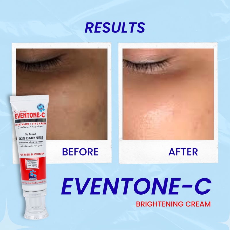 EVENTONE C CREAM