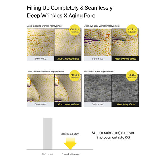 CELIMAX RETINAL SHOT 30 MG